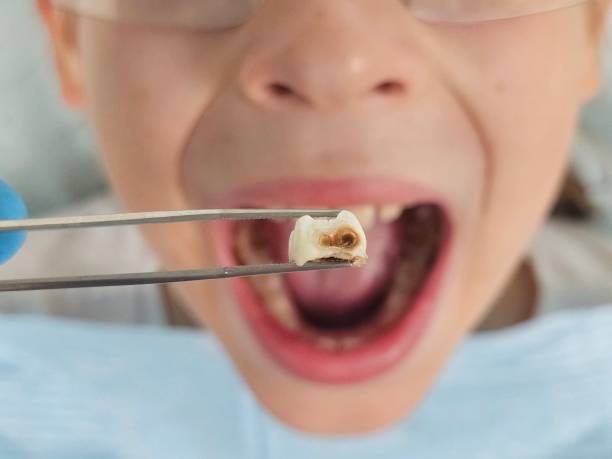 Best Urgent Tooth Repair  in Allentown, PA